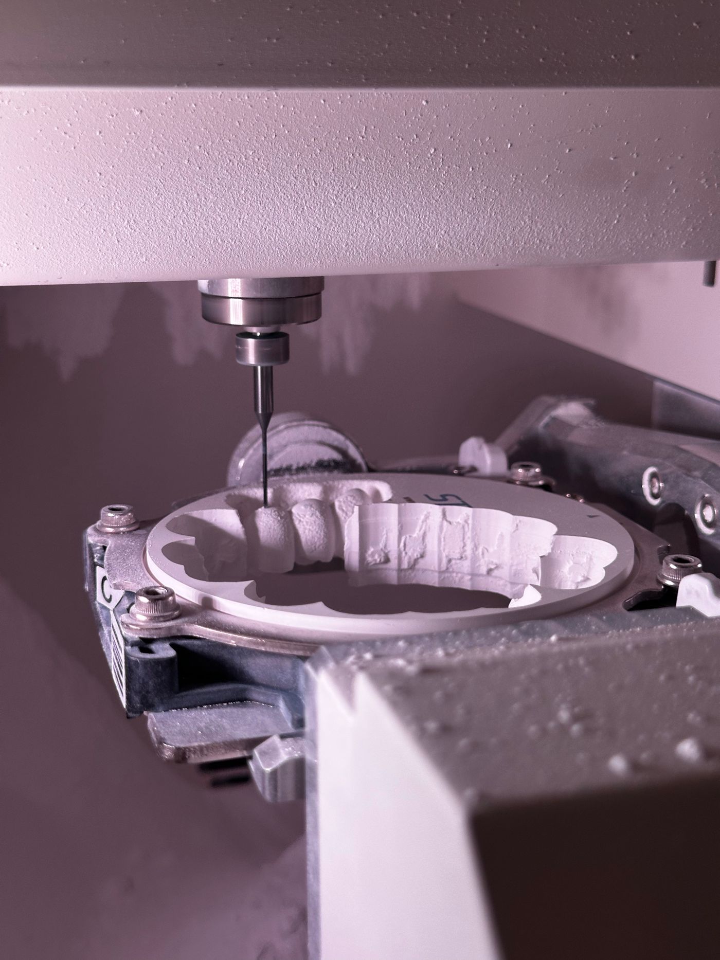 Precision grinding of a metal component